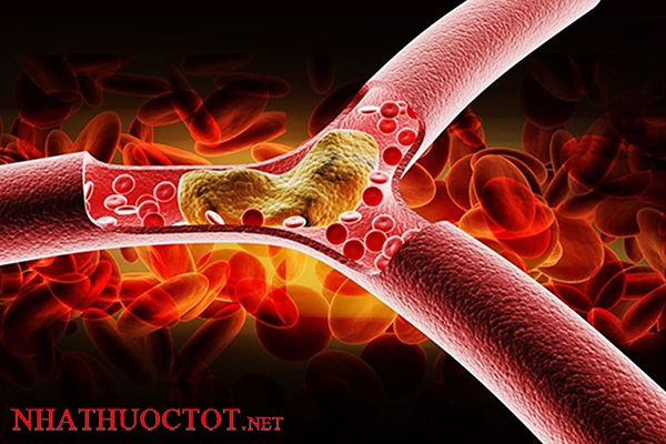 Lợi ích sử dụng hạt methi chữa đái tháo đường